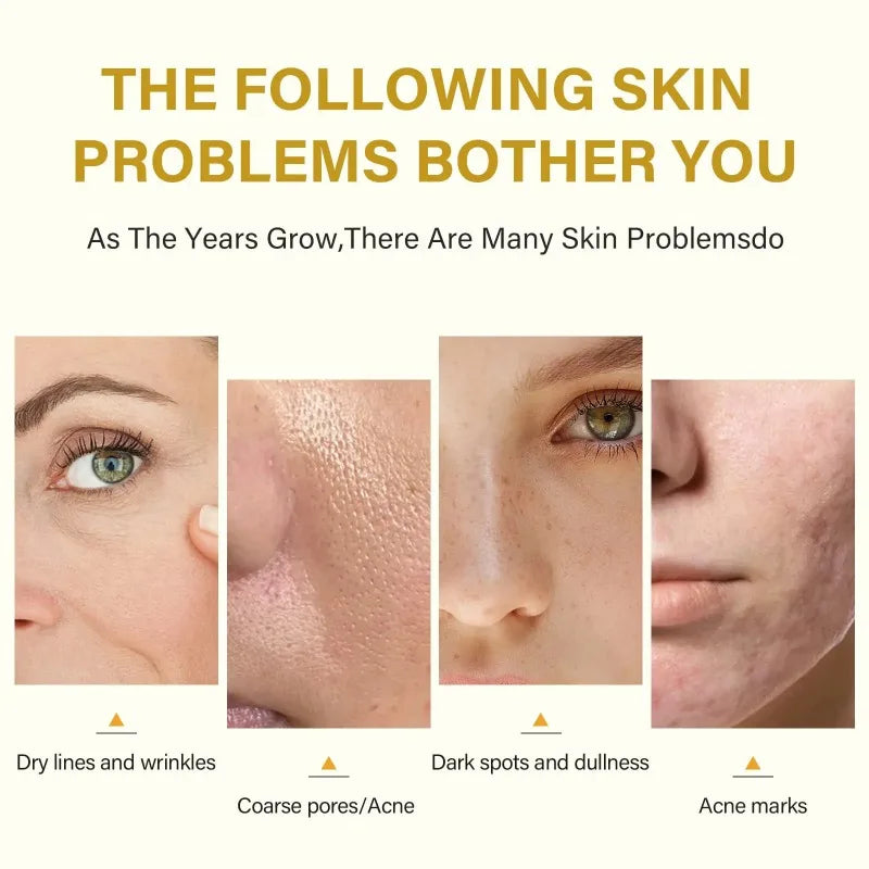 Acid Peeling Serum Chemical Exfoliant Peel for remove Face Dark Skin Spots Whiten Lighten Melanin Peeling Solution Skin Peel