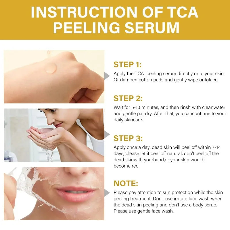 Acid Peeling Serum Chemical Exfoliant Peel for remove Face Dark Skin Spots Whiten Lighten Melanin Peeling Solution Skin Peel